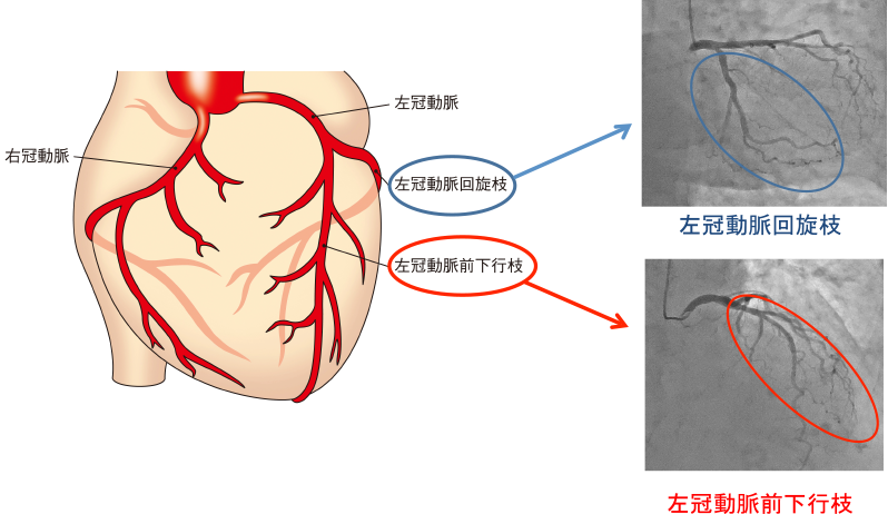 左冠動脈回旋枝　左冠動脈前下行枝